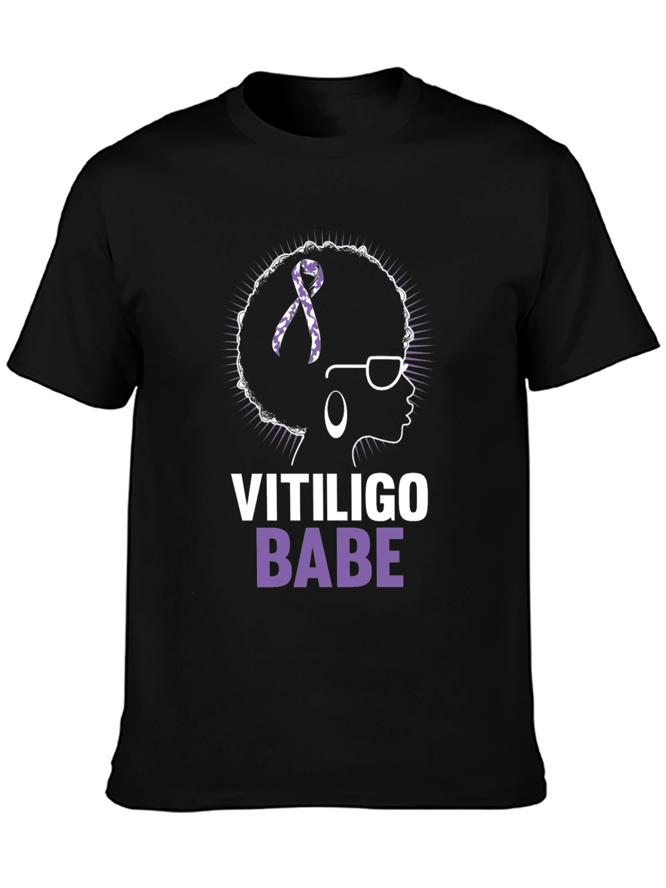 Vitiligo Babe T-Shirt - Awareness & Empowerment