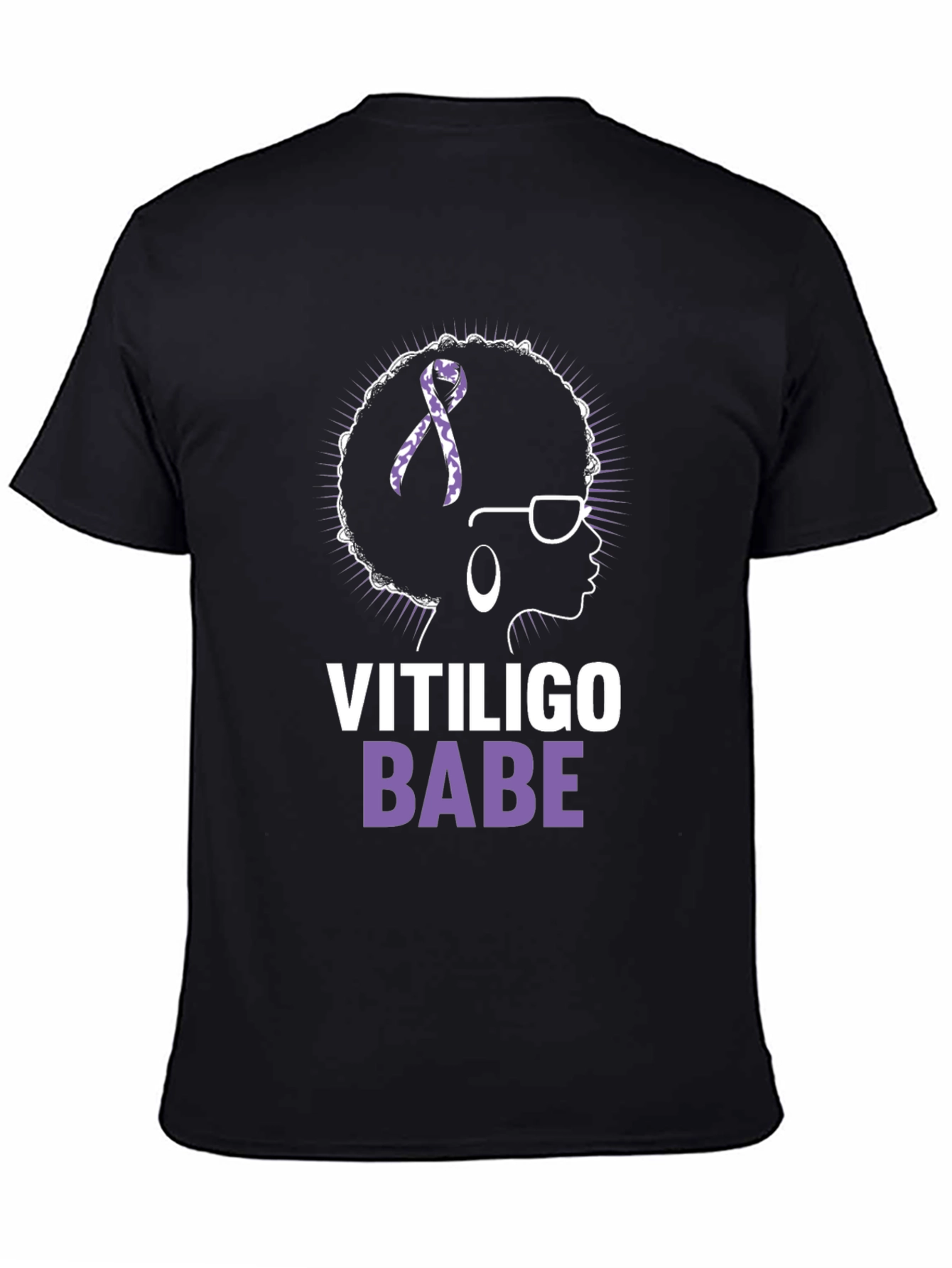 Vitiligo Babe T-Shirt - Awareness & Empowerment