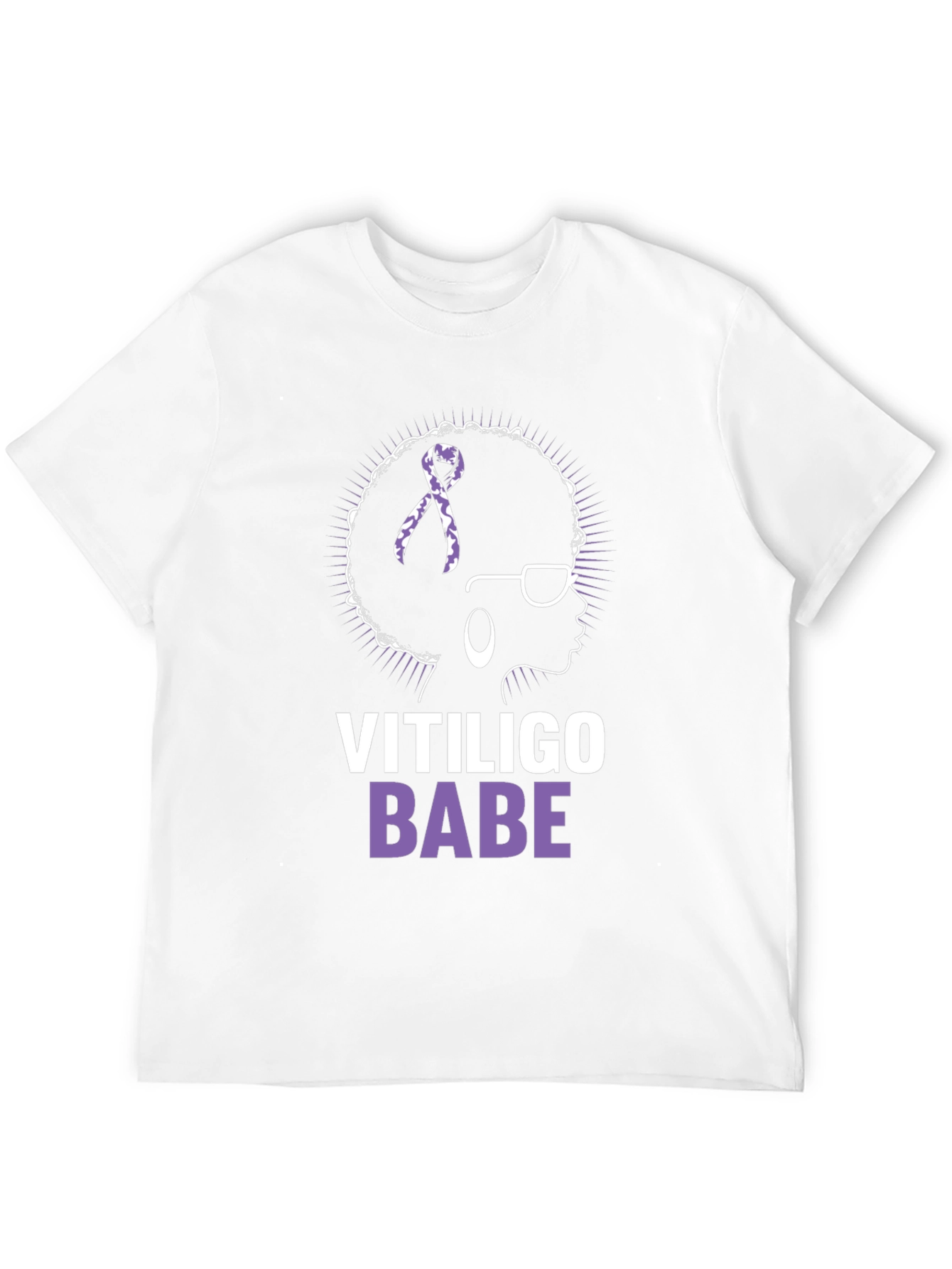 Vitiligo Babe T-Shirt - Awareness & Empowerment