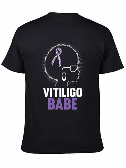 Vitiligo Babe T-Shirt - Awareness & Empowerment