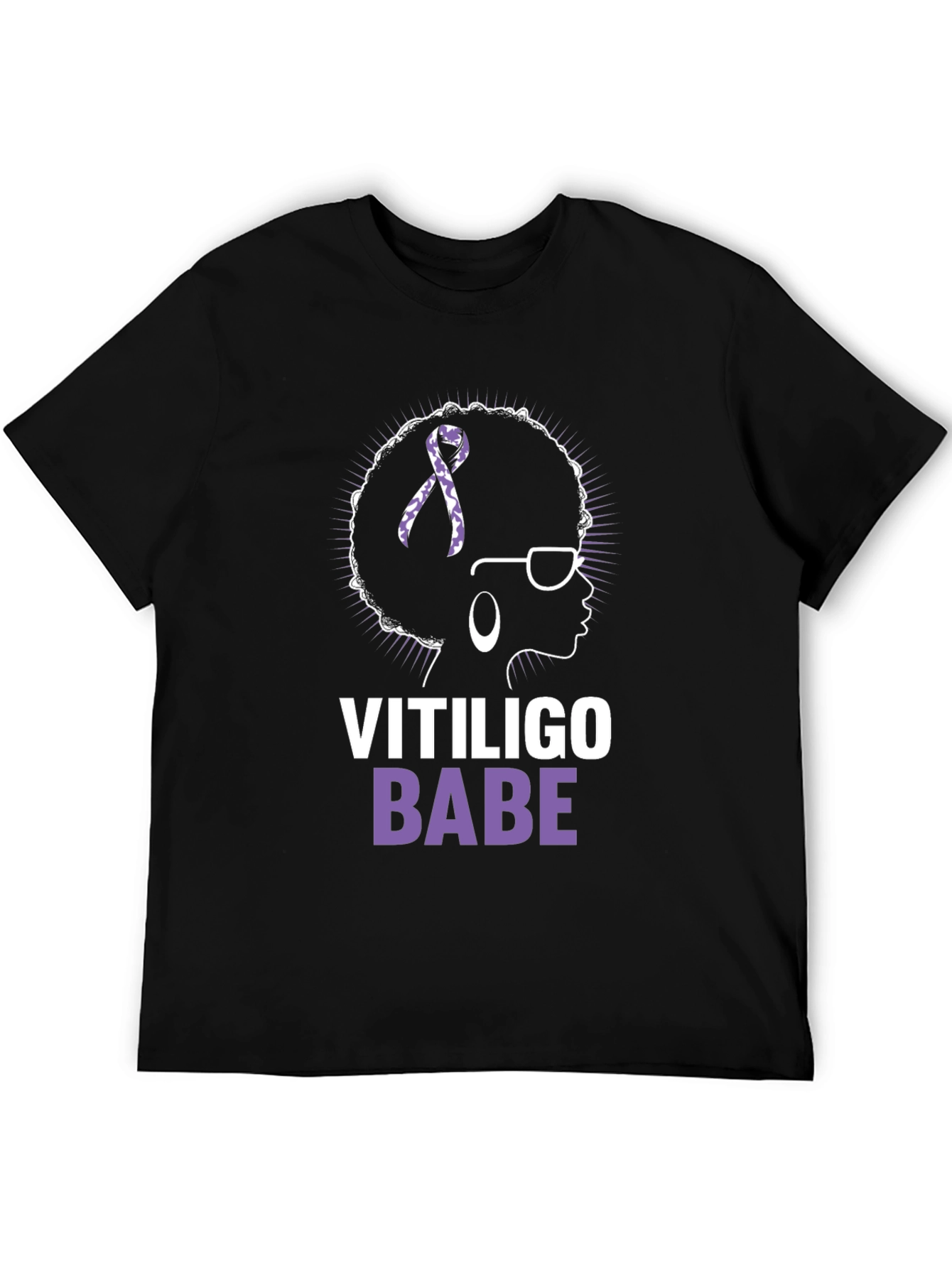 Vitiligo Babe T-Shirt - Awareness & Empowerment