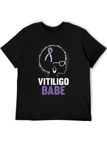 Vitiligo Babe T-Shirt - Awareness & Empowerment