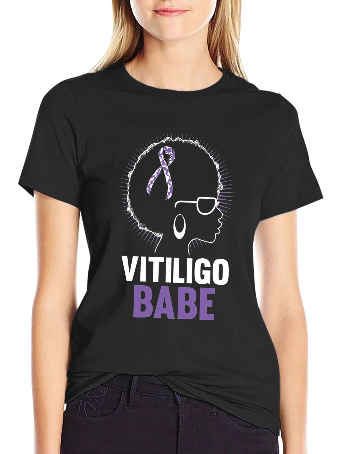 Vitiligo Babe T-Shirt - Awareness & Empowerment
