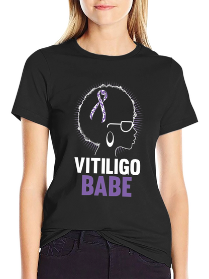 Vitiligo Babe T-Shirt - Awareness & Empowerment
