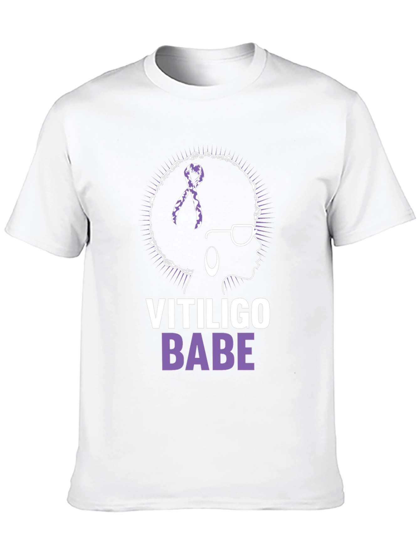 Vitiligo Babe T-Shirt - Awareness & Empowerment