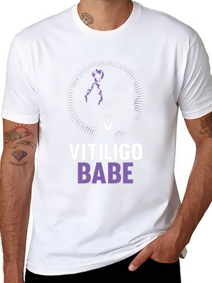 Vitiligo Babe T-Shirt - Awareness & Empowerment